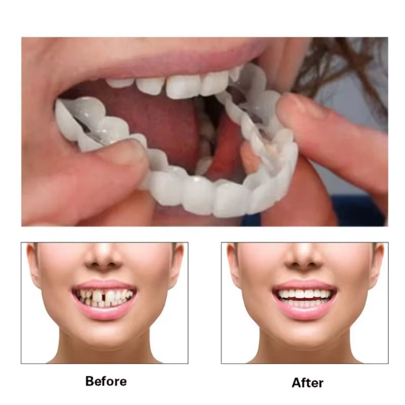 Veneers dentaires temporaires réutilisables, sourire instantané, antidérapants, ajustement ferme pour une longue durée de conversation H2931