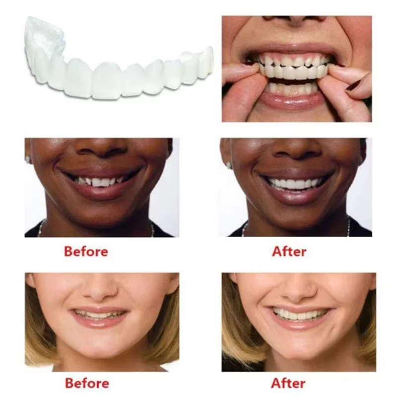 Veneers dentaires temporaires réutilisables, sourire instantané, antidérapants, ajustement ferme pour une longue durée de conversation H2931