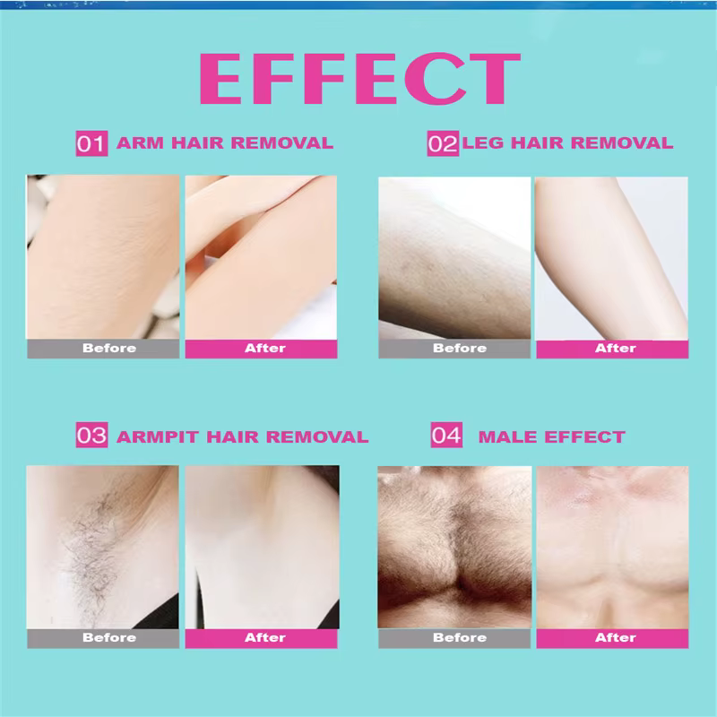 Lot de 10 bandes de cire dépilatoire en rouleau pour aisselles, outil de beauté pour l'épilation des jambes, du corps et du visage, soin de la peau pour femmes